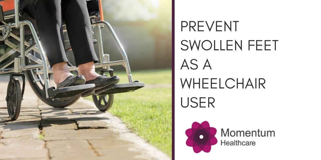 How to Prevent Swollen Feet as a Wheelchair User